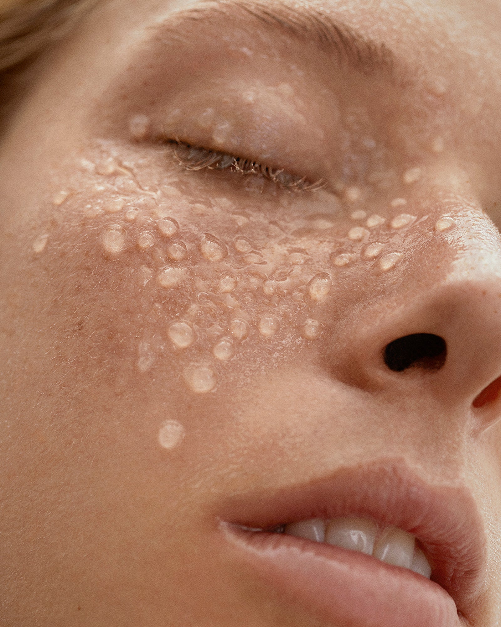Combined skin